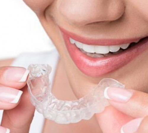 Invisalign