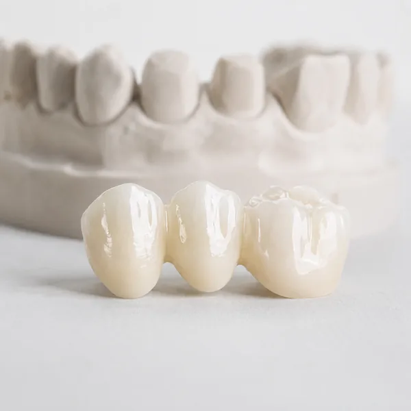 Prótesis dental a medida en Bormujos